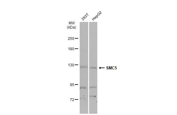 SMC5 Antibody
