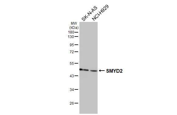 SMYD2 Antibody - BSA Free