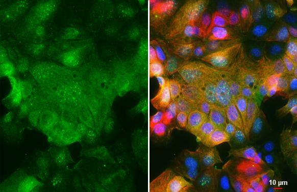 SMYD3 Antibody - BSA Free