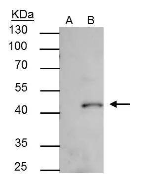 SMYD3 Antibody