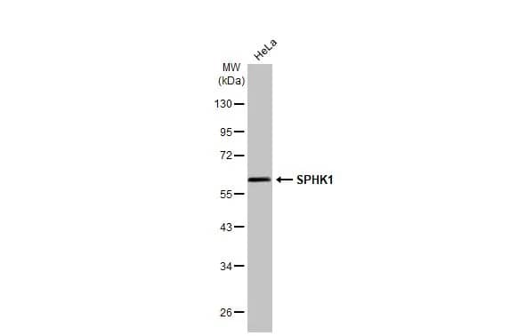 Sphingosine Kinase 1/SPHK1 Antibody