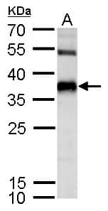 SPRY4 Antibody