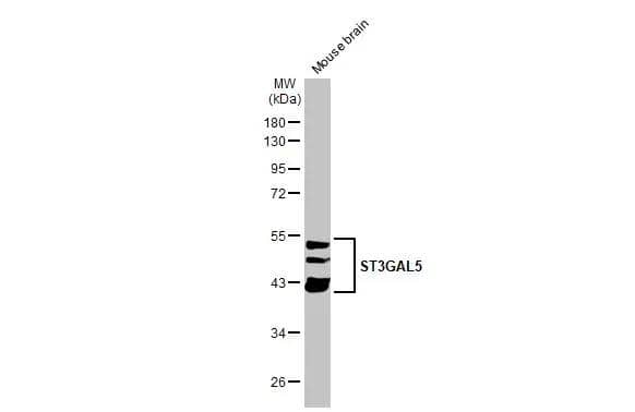 ST3GAL5 Antibody - BSA Free
