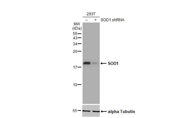 SOD1/Cu-Zn SOD Antibody