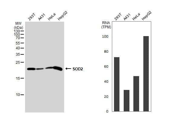 SOD2/Mn-SOD Antibody