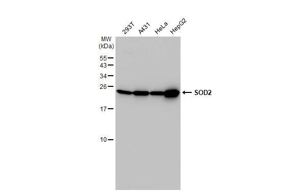 SOD2/Mn-SOD Antibody - BSA Free
