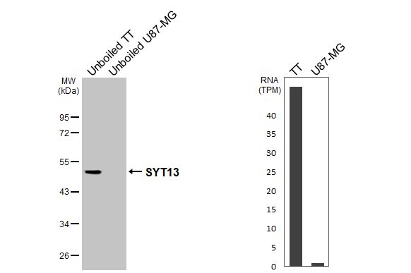 Synaptotagmin 13 Antibody - BSA Free