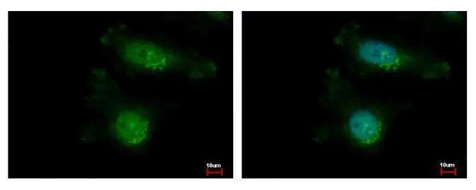 TAO2 Antibody - BSA Free