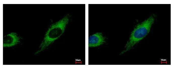 TBRG4 Antibody - BSA Free