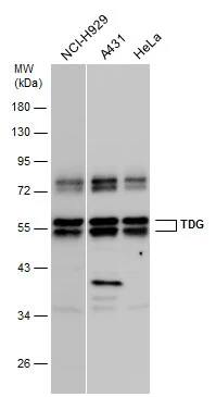 TDG Antibody