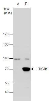 TIGD1 Antibody - BSA Free