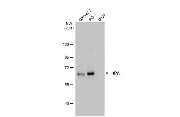 t-Plasminogen Activator/tPA Antibody