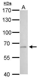 t-Plasminogen Activator/tPA Antibody
