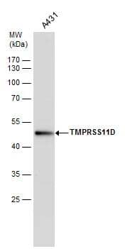 Airway Trypsin-like Protease/HAT/TMPRSS11D Antibody - BSA Free