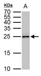 TPPP/p25 Antibody
