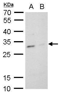 TPPP/p25 Antibody