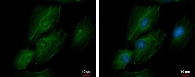 transgelin 2 Antibody
