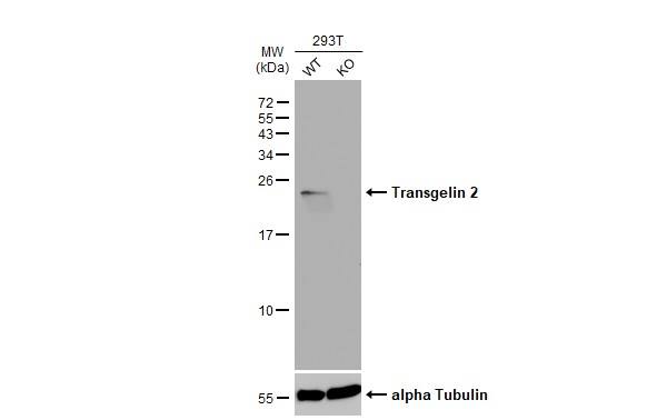transgelin 2 Antibody