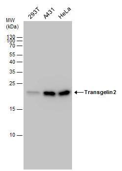 transgelin 2 Antibody