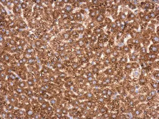 Transketolase Antibody