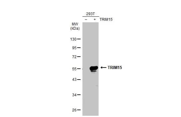 TRIM15 Antibody