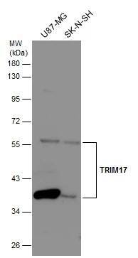 TRIM17 Antibody - BSA Free