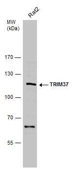 TRIM37 Antibody - BSA Free