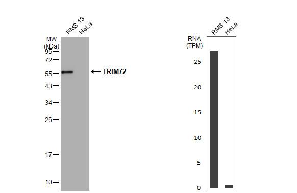 TRIM72 Antibody
