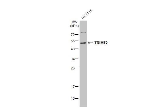 TRIM72 Antibody - BSA Free