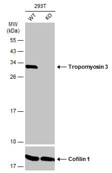 tropomyosin-3 Antibody - BSA Free