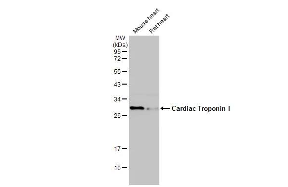 Troponin I Type 3 (cardiac) Antibody
