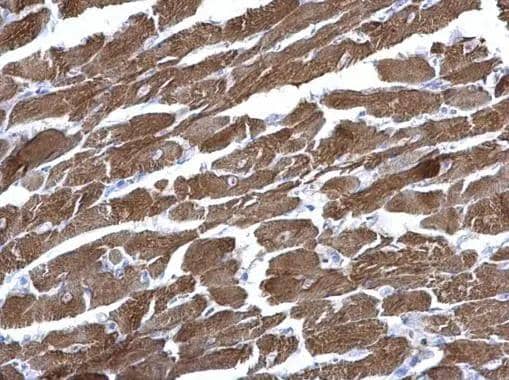 Troponin I Type 3 (cardiac) Antibody - Azide Free