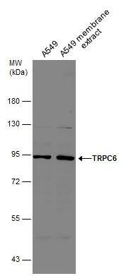 TRPC6 Antibody - BSA Free