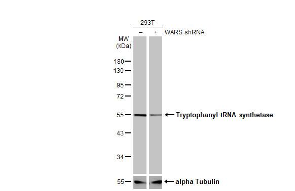 Tryptophanyl tRNA synthetase Antibody