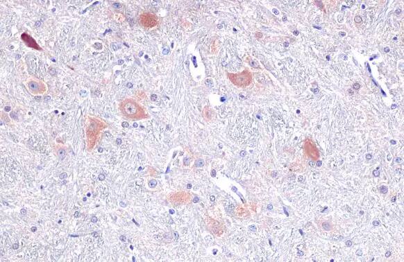 Tryptophanyl tRNA synthetase Antibody