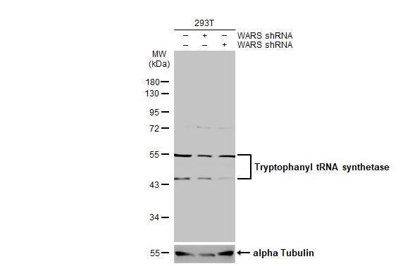 Tryptophanyl tRNA synthetase Antibody