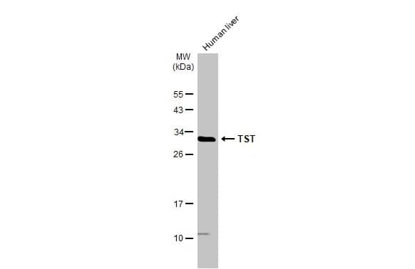 TST Antibody