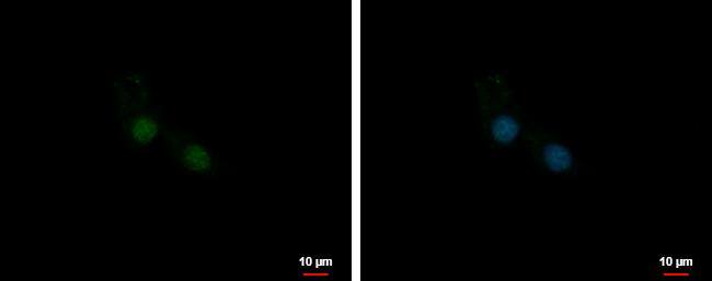U11/U12-35K Antibody - BSA Free
