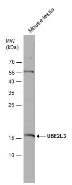 UbcH7/UBE2L3 Antibody
