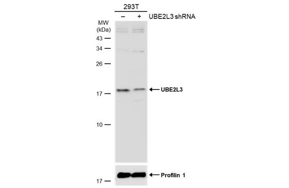 UbcH7/UBE2L3 Antibody - BSA Free