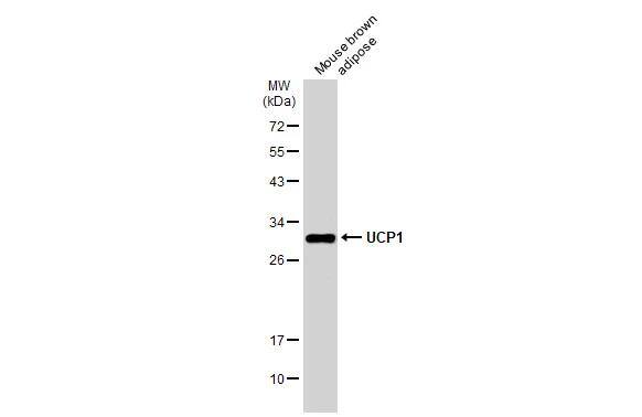 UCP1 Antibody