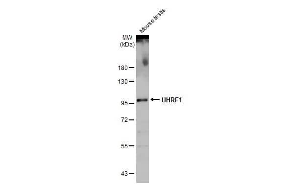 UHRF1 Antibody