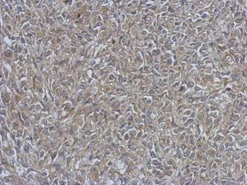 FERMT3/URP2 Antibody