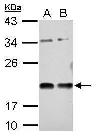 Vasohibin Antibody