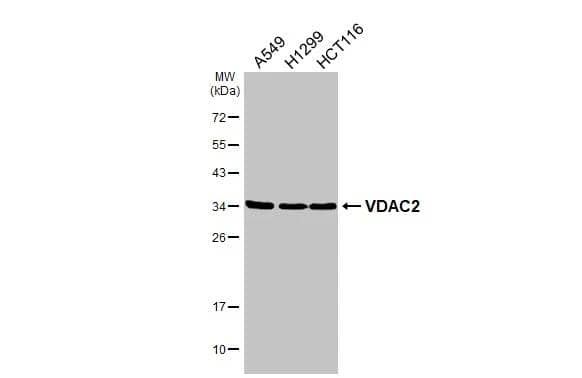 VDAC2 Antibody - BSA Free