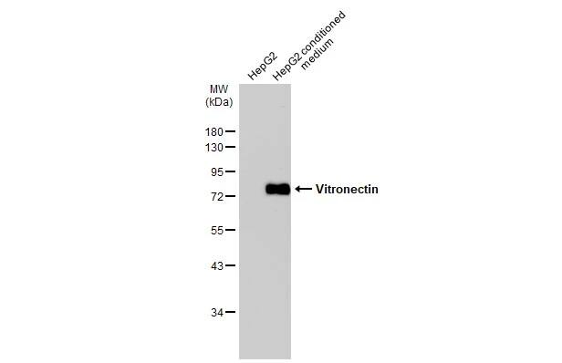 Vitronectin Antibody
