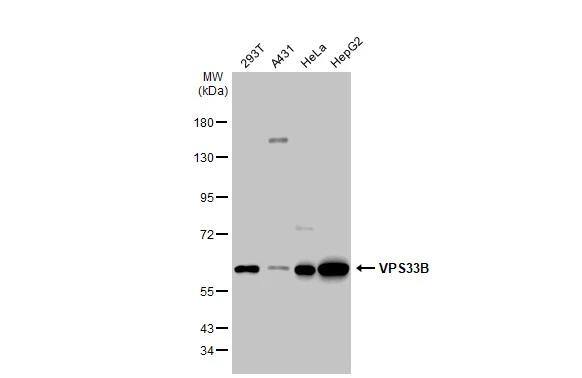 VPS33B Antibody - BSA Free