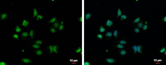 VPS4B Antibody - BSA Free