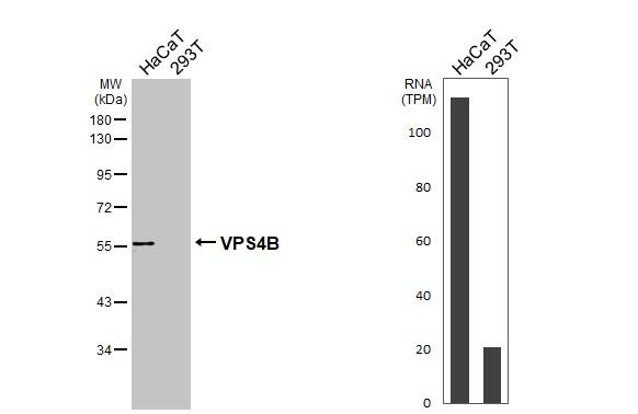 VPS4B Antibody - BSA Free