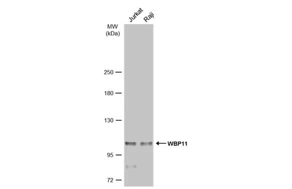 WBP11 Antibody